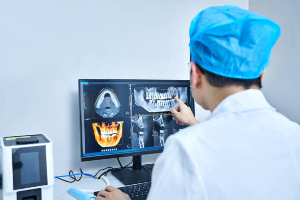 Best Emergency Treatment for Dental Infections or Abscesses in Morningside, MD