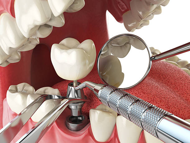 Best Cosmetic Emergency Dentistry in Morningside, MD